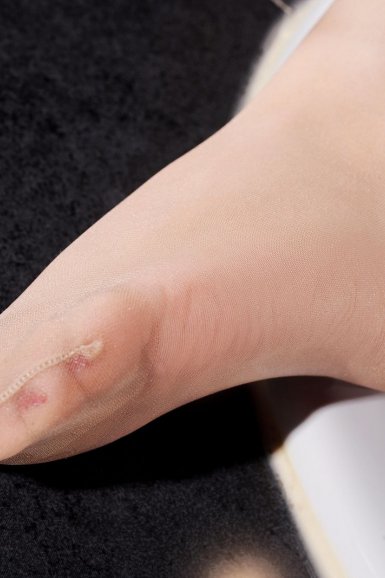 成都白斑医院解答想尽快治疗男性白斑应该怎么做呢-kaiyun官网(图1) kaiyun登录入口